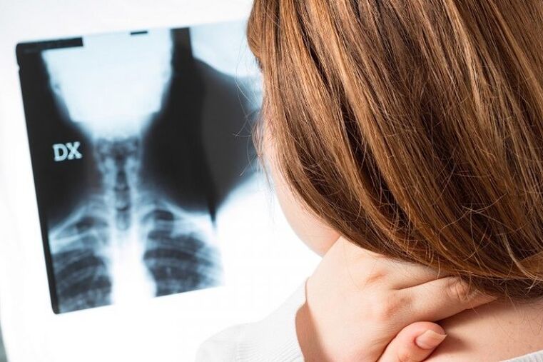 X -ray аз минтақаи гарданагӣ